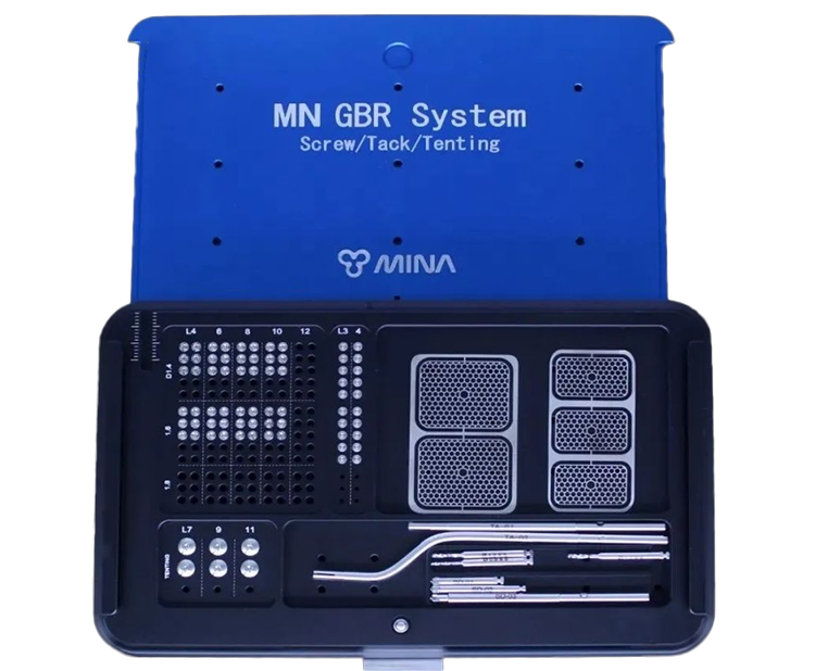 MINA GBR System